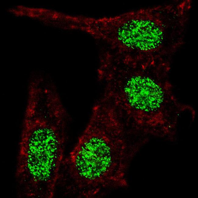 KLF4 Antibody - Fluorescent confocal image of HeLa cells stained KLF4 (S457) antibody. HeLa cells were fixed with 4% PFA (20 min), permeabilized with Triton X-100 (0.2%, 30 min), then incubated KLF4 (S457) primary antibody (1:100, 2 h at room temperature). For secondary antibody, Alexa Fluor 488 conjugated donkey anti-rabbit antibody (green) was used (1:1000, 1h). Cytoplasmic actin was counterstained with Alexa Fluor 555 (red) conjugated Phalloidin (5.25 mu M, 25 min). Note the highly specific localization of the phosphorylated KLF4 immunoreactivity to the nuclei but not the cytoplasm.