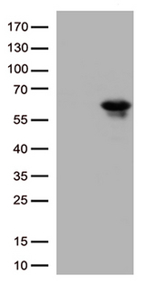 KLF5 / BTEB2 Antibody - HEK293T cells were transfected with the pCMV6-ENTRY control. (Left lane) or pCMV6-ENTRY KLF5. (Right lane) cDNA for 48 hrs and lysed. Equivalent amounts of cell lysates. (5 ug per lane) were separated by SDS-PAGE and immunoblotted with anti-KLF5. (1:500)