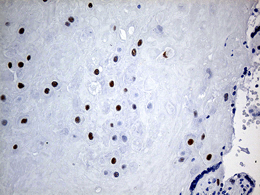 KLF5 / BTEB2 Antibody - Immunohistochemical staining of paraffin-embedded Human placenta tissue within the normal limits using anti-KLF5 mouse monoclonal antibody. (Heat-induced epitope retrieval by 1mM EDTA in 10mM Tris buffer. (pH8.5) at 120 oC for 3 min. (1:500)