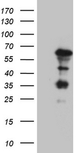 KLF5 / BTEB2 Antibody - HEK293T cells were transfected with the pCMV6-ENTRY control. (Left lane) or pCMV6-ENTRY KLF5. (Right lane) cDNA for 48 hrs and lysed