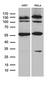 KLF5 / BTEB2 Antibody - Western blot analysis of extracts. (35ug) from 2 cell lines by using anti-KLF5 monoclonal antibody. (1:500)