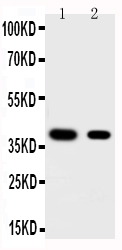 KLF5 / BTEB2 Antibody - Anti-KLF5 antibody, Western blotting Lane 1: HELA Cell LysateLane 2: MCF-7 Cell Lysate