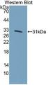 KLF5 / BTEB2 Antibody - Western blot of KLF5 / BTEB2 antibody.