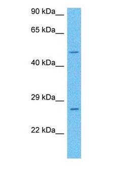 KLF5 / BTEB2 Antibody - Western blot of KLF5 Antibody with human Fetal Liver lysate.  This image was taken for the unconjugated form of this product. Other forms have not been tested.