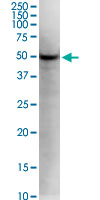 KLF5 / BTEB2 Antibody - KLF5 monoclonal antibody (M01), clone 2G12. Western Blot analysis of KLF5 expression in HeLa.