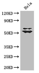 KLF5 / BTEB2 Antibody - Positive WB detected in:Hela whole cell lysate;All lanes: KLF5 antibody at 3ug/ml;Secondary;Goat polyclonal to rabbit IgG at 1/50000 dilution;Predicted band size: 51,34,19,42 kDa;Observed band size: 51,60 kDa;