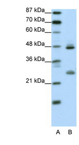 KLF6 Antibody - KLF6 antibody Western blot of Transfected 293T cell lysate. This image was taken for the unconjugated form of this product. Other forms have not been tested.