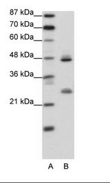 KLF6 Antibody - A: Marker, B: Transfected 293T Cell Lysate.  This image was taken for the unconjugated form of this product. Other forms have not been tested.