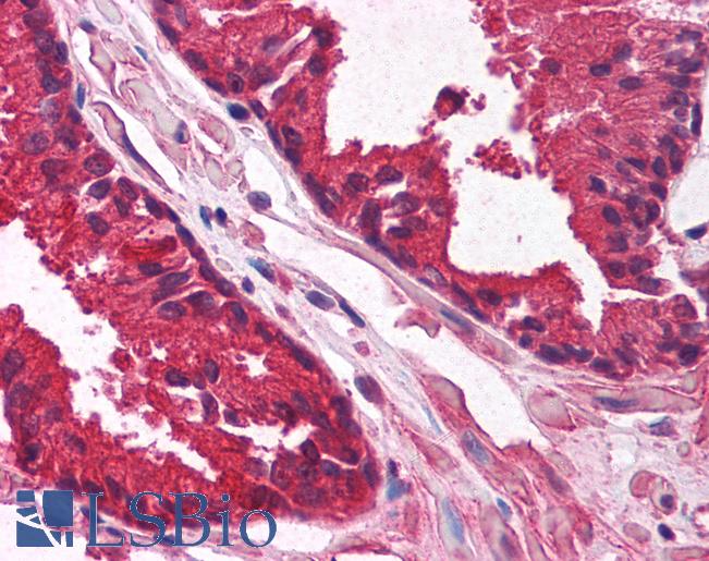 KLF6 Antibody - Anti-KLF6 antibody IHC of human prostate. Immunohistochemistry of formalin-fixed, paraffin-embedded tissue after heat-induced antigen retrieval. Antibody concentration 5 ug/ml.  This image was taken for the unconjugated form of this product. Other forms have not been tested.