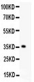 KLF6 Antibody - KLF6 antibody Western blot. All lanes: Anti KLF6 at 0.5 ug/ml. WB: Recombinant Human KLF6 Protein 0.5ng. Predicted band size: 36 kD. Observed band size: 36 kD.