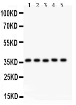 KLF6 Antibody - KLF6 antibody Western blot. All lanes: Anti KLF6 at 0.5 ug/ml. Lane 1: Human Placenta Tissue Lysate at 50 ug. Lane 2: Rat Testis Tissue Lysate at 50 ug. Lane 3: HELA Whole Cell Lysate at 40 ug. Lane 4: HEPG2 Whole Cell Lysate at 40 ug. Lane 5: HEPA Whole Cell Lysate at 40 ug. Predicted band size: 32 kD. Observed band size: 37 kD.