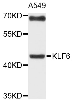 KLF6 Antibody - Western blot analysis of extracts of A-549 cells, using KLF6 antibody at 1:1000 dilution. The secondary antibody used was an HRP Goat Anti-Rabbit IgG (H+L) at 1:10000 dilution. Lysates were loaded 25ug per lane and 3% nonfat dry milk in TBST was used for blocking. An ECL Kit was used for detection and the exposure time was 60s.