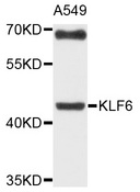KLF6 Antibody - Western blot analysis of extracts of A-549 cells, using KLF6 antibody at 1:1000 dilution. The secondary antibody used was an HRP Goat Anti-Rabbit IgG (H+L) at 1:10000 dilution. Lysates were loaded 25ug per lane and 3% nonfat dry milk in TBST was used for blocking. An ECL Kit was used for detection and the exposure time was 60s.