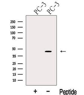KLF6 Antibody - Western blot analysis of extracts of PC-3 cells using KLF6 antibody. The lane on the left was treated with blocking peptide.