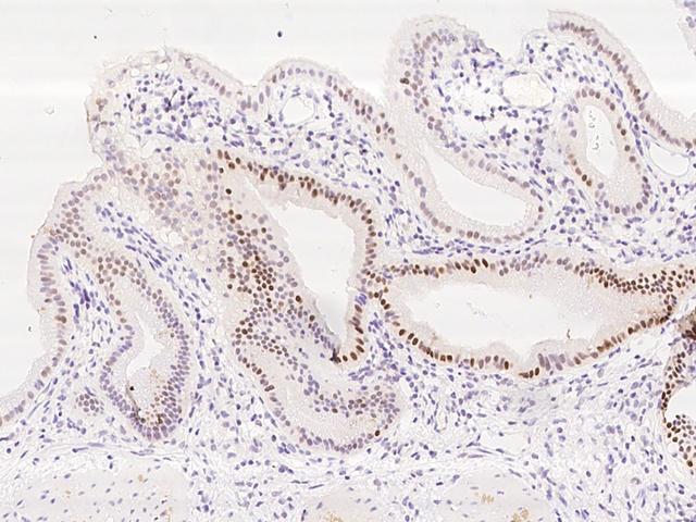 KLF6 Antibody - Immunochemical staining of human KLF6 in human gallbladder with rabbit polyclonal antibody at 1:2000 dilution, formalin-fixed paraffin embedded sections.