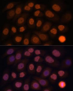 KLF6 Antibody - Immunofluorescence analysis of HeLa cells using KLF6 Polyclonal Antibody at dilution of 1:100.Blue: DAPI for nuclear staining.