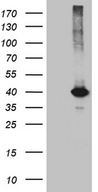 KLF7 Antibody - HEK293T cells were transfected with the pCMV6-ENTRY control. (Left lane) or pCMV6-ENTRY KLF7. (Right lane) cDNA for 48 hrs and lysed