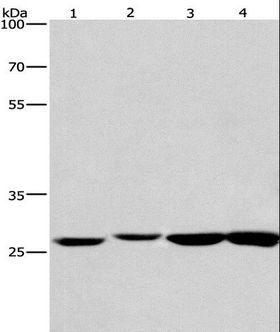 KLF7 Antibody - Western blot analysis of Human colon cancer and mouse kidney tissue, mouse testis and human fetal brain tissue, using KLF7 Polyclonal Antibody at dilution of 1:483.3.