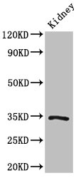 KLF7 Antibody - Positive Western Blot detected in Mouse kidney tissue. All lanes: KLF7 antibody at 3 µg/ml Secondary Goat polyclonal to rabbit IgG at 1/50000 dilution. Predicted band size: 34, 30, 25, 31, 14, 10 KDa. Observed band size: 34 KDa