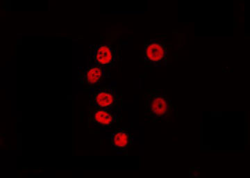 KLF7 Antibody - Staining COLO205 cells by IF/ICC. The samples were fixed with PFA and permeabilized in 0.1% Triton X-100, then blocked in 10% serum for 45 min at 25°C. The primary antibody was diluted at 1:200 and incubated with the sample for 1 hour at 37°C. An Alexa Fluor 594 conjugated goat anti-rabbit IgG (H+L) Ab, diluted at 1/600, was used as the secondary antibody.