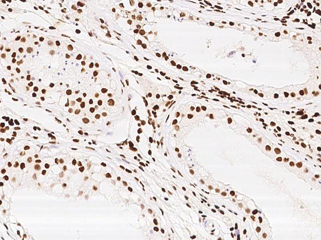 KLF7 Antibody - Immunochemical staining KLF7 in human testis with rabbit polyclonal antibody at 1:300 dilution, formalin-fixed paraffin embedded sections.