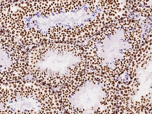 KLF7 Antibody - Immunochemical staining KLF7 in mouse testis with rabbit polyclonal antibody at 1:300 dilution, formalin-fixed paraffin embedded sections.