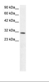 KLF8 Antibody - Fetal Kidney Lysate.  This image was taken for the unconjugated form of this product. Other forms have not been tested.