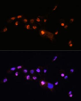 KLF8 Antibody - Immunofluorescence analysis of A431 cells using KLF8 Polyclonal Antibody at dilution of 1:100.Blue: DAPI for nuclear staining.