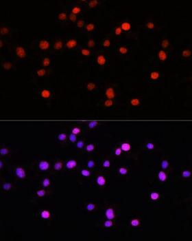 KLF8 Antibody - Immunofluorescence analysis of L929 cells using KLF8 Polyclonal Antibody at dilution of 1:100.Blue: DAPI for nuclear staining.