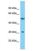 KLHDC10 Antibody - KLHDC10 antibody Western Blot of Breast Tumor. Antibody dilution: 1 ug/ml.  This image was taken for the unconjugated form of this product. Other forms have not been tested.