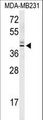 KLHDC2 / LCP Antibody - Western blot of KLDC2 Antibody in MDA-MB231 cell line lysates (35 ug/lane). KLDC2 (arrow) was detected using the purified antibody.