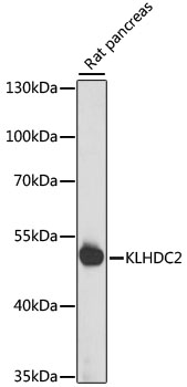 KLHDC2 / LCP Antibody - Western blot analysis of extracts of rat pancreas, using KLHDC2 antibody at 1:1000 dilution. The secondary antibody used was an HRP Goat Anti-Rabbit IgG (H+L) at 1:10000 dilution. Lysates were loaded 25ug per lane and 3% nonfat dry milk in TBST was used for blocking. An ECL Kit was used for detection and the exposure time was 15s.