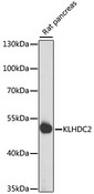 KLHDC2 / LCP Antibody - Western blot analysis of extracts of rat pancreas, using KLHDC2 antibody at 1:1000 dilution. The secondary antibody used was an HRP Goat Anti-Rabbit IgG (H+L) at 1:10000 dilution. Lysates were loaded 25ug per lane and 3% nonfat dry milk in TBST was used for blocking. An ECL Kit was used for detection and the exposure time was 15s.