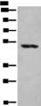 KLHDC2 / LCP Antibody - Western blot analysis of Human placenta tissue lysate  using KLHDC2 Polyclonal Antibody at dilution of 1:400