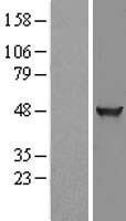 KLHDC2 / LCP Protein - Western validation with an anti-DDK antibody * L: Control HEK293 lysate R: Over-expression lysate