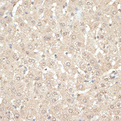 KLHDC3 Antibody - Immunohistochemistry of paraffin-embedded rat liver using KLHDC3 antibody at dilution of 1:100 (40x lens).