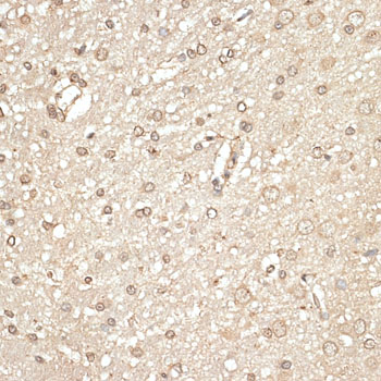 KLHDC3 Antibody - Immunohistochemistry of paraffin-embedded rat brain using KLHDC3 antibody at dilution of 1:100 (40x lens).