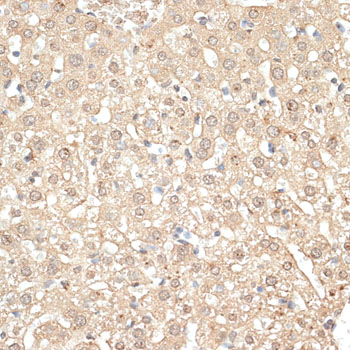 KLHDC3 Antibody - Immunohistochemistry of paraffin-embedded mouse liver using KLHDC3 antibody at dilution of 1:100 (40x lens).