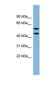 KLHDC4 Antibody - KLHDC4 antibody Western blot of Placenta lysate. This image was taken for the unconjugated form of this product. Other forms have not been tested.