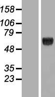 KLHDC4 Protein - Western validation with an anti-DDK antibody * L: Control HEK293 lysate R: Over-expression lysate
