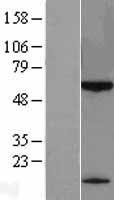 KLHDC7B Protein - Western validation with an anti-DDK antibody * L: Control HEK293 lysate R: Over-expression lysate