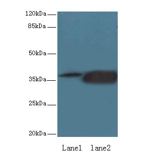 KLHDC8A Antibody - Western blot. All lanes: KLHDC8A antibody at 0.5 ug/ml. Lane 1: Jurkat whole cell lysate. Lane 2: Mouse liver tissue. Secondary Goat polyclonal to Rabbit IgG at 1:10000 dilution. Predicted band size: 34 kDa. Observed band size: 34 kDa.
