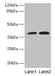 KLHDC8A Antibody - Western blot All lanes: KLHDC8A antibody at 0.5µg/ml Lane 1: Jurkat whole cell lysate Lane 2: Mouse liver tissue Secondary Goat polyclonal to rabbit IgG at 1/10000 dilution Predicted band size: 34 kDa Observed band size: 34 kDa