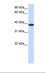 KLHDC8B Antibody - Jurkat cell lysate. Antibody concentration: 1.0 ug/ml. Gel concentration: 12%.  This image was taken for the unconjugated form of this product. Other forms have not been tested.