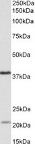 KLHDC8B Antibody - KLHDC8B antibody (0.5 ug/ml) staining of Daudi lysate (35 ug protein in RIPA buffer). Primary incubation was 1 hour. Detected by chemiluminescence.