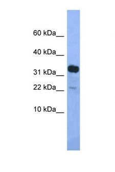 KLHDC9 Antibody - KLHDC9 antibody Western blot of Mouse Pancreas lysate. Antibody concentration 1 ug/ml.  This image was taken for the unconjugated form of this product. Other forms have not been tested.