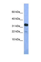KLHDC9 Antibody - KLHDC9 antibody Western blot of Mouse Pancreas lysate. Antibody concentration 1 ug/ml.  This image was taken for the unconjugated form of this product. Other forms have not been tested.