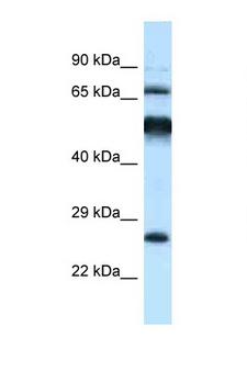 KLHL1 Antibody - KLHL1 antibody Western blot of Rat Brain lysate. Antibody concentration 1 ug/ml.  This image was taken for the unconjugated form of this product. Other forms have not been tested.