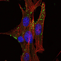 KLHL1 Antibody - Immunofluorescence of NIH/3T3 cells using KLHL1 mouse monoclonal antibody (green). Red: Actin filaments have been labeled with Alexa Fluor-555 phalloidin.