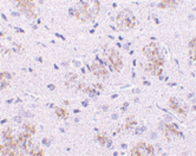 KLHL1 Antibody - Immunohistochemistry of KLHL1 in rat brain tissue with KLHL1 antibody at 10 ug/ml.
